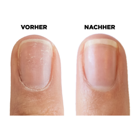 SolarOil - Nagel- und Nagelhautöl 7,38 ml CND 2