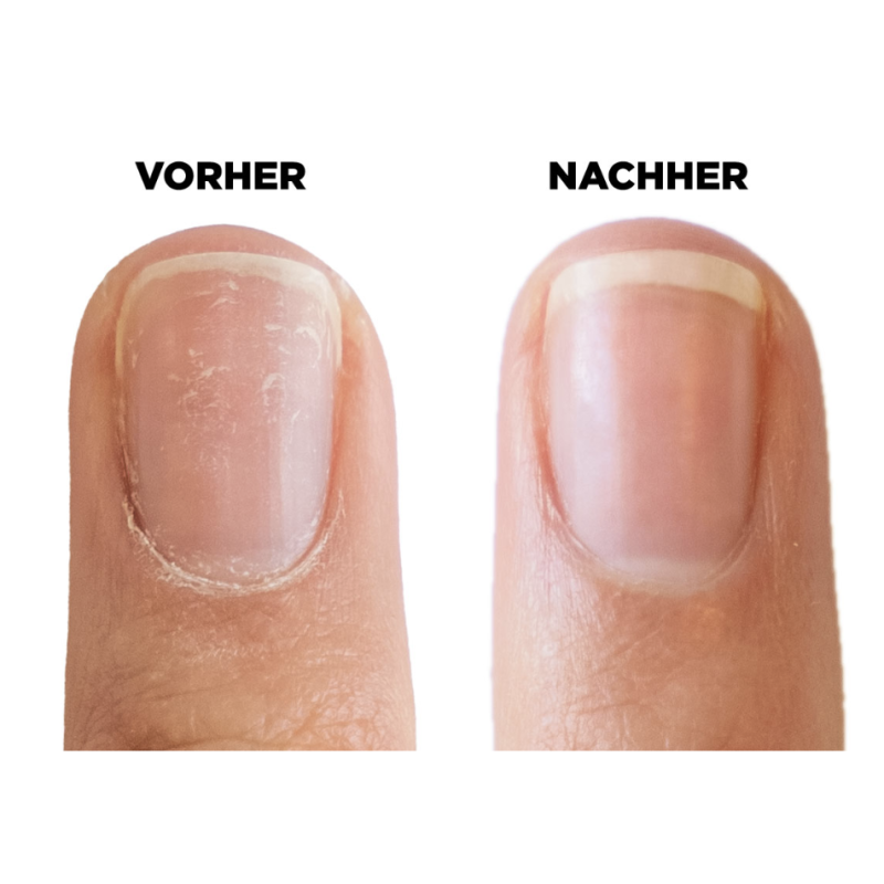 SolarOil - Nagel- und Nagelhautöl 7,38 ml CND-NAGELHAUTÖL-Double Beauty Shop