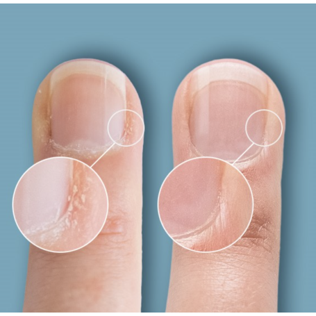 Cuticle Eraser - Cuticle Remover 15 ml CND